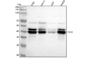 Western blot analysis of TRIB3 using anti-TRIB3 antibody (ABIN7606576).