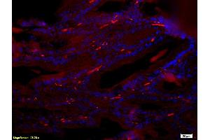 Formalin-fixed and paraffin-embedded : rat breast tissue labeled with Rabbit Anti-Reprimo Polyclonal Antibody (ABIN735863), Unconjugated 1:200 followed by conjugation to the secondary PE antibody and DABI staining (Reprimo antibody  (AA 41-109))