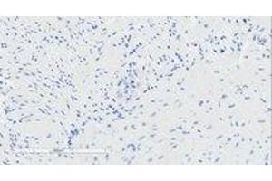 Image no. 2 for anti-omega-3 Fatty Acid Receptor 1 (O3FAR1) antibody (ABIN5920231) (O3FAR1 antibody)