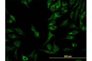 Image no. 4 for anti-Chromosome 21 Open Reading Frame 33 (C21orf33) (AA 188-269) antibody (ABIN599034) (C21orf33 antibody  (AA 188-269))