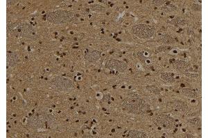 ABIN6272947 at 1/100 staining Rat brain tissue by IHC-P. (NSUN2 antibody  (Internal Region))