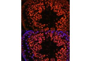 Immunofluorescence analysis of rat testis using UBQLN3 antibody (ABIN7271123) at dilution of 1:100. (Ubiquilin 3 antibody  (AA 306-620))