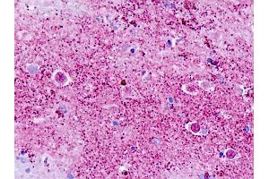 Human, Brain, Cortex: Formalin-Fixed Paraffin-Embedded (FFPE) (GPR173 antibody  (C-Term))