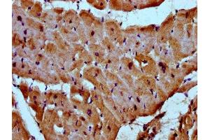 IHC image of ABIN7160664 diluted at 1:300 and staining in paraffin-embedded human heart tissue performed on a Leica BondTM system. (MYOZ2 antibody  (AA 90-180))