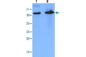 Western blot analysis of cell lysates (each 40 ug) by PDZK1 monoclonal antibody, clone AT1A2  (1:1000). (PDZK1 antibody  (AA 1-519))