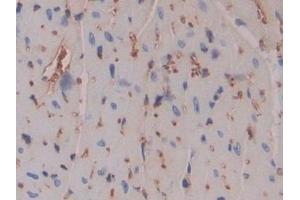 Immunohistochemistry (IHC) image for anti-Pregnancy Zone Protein (PZP) (AA 1224-1495) antibody (ABIN7438847)