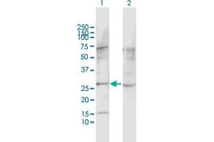 Western Blot analysis of LPHN1 expression in transfected 293T cell line by LPHN1 MaxPab polyclonal antibody. (Latrophilin 1 antibody  (AA 1-201))