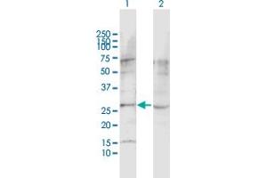 Western Blot analysis of LPHN1 expression in transfected 293T cell line by LPHN1 MaxPab polyclonal antibody.
