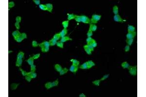 Immunofluorescence staining of SH-SY5Y cells with ABIN7150765 at 1:200, counter-stained with DAPI. (DUSP26 antibody  (AA 1-211))