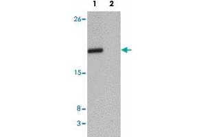Western blot analysis of CXXC4 in human brain tissue lysate with CXXC4 polyclonal antibody  at 1 ug/mL in (1) the absence and (2) the presence of blocking peptide.
