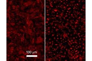 Immunofluorescence (IF) image for anti-Nuclear Factor-kB p65 (NFkBP65) (C-Term) antibody (ABIN964680)