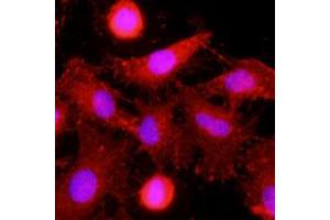 Immunofluorescence of human HeLa cells stained with monoclonal anti-human MINCLE antibody (1:500) with Texas Red (Red). (CLEC4E antibody)