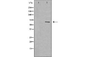 Western blot analysis of extracts of lung tissue, using GPC3 antibody. (Glypican 3 antibody  (N-Term))
