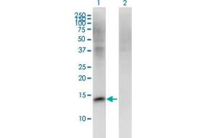 Western Blot analysis of FMN2 expression in transfected 293T cell line by FMN2 monoclonal antibody (M06), clone 1C2.
