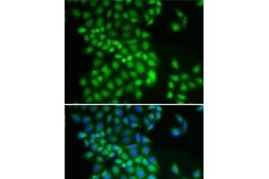 Immunofluorescence analysis of A-549 cells using YTHDC1 Polyclonal Antibody (YTHDC1 antibody)