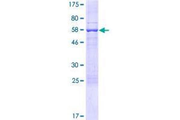 SCML4 Protein (AA 1-305) (GST tag)