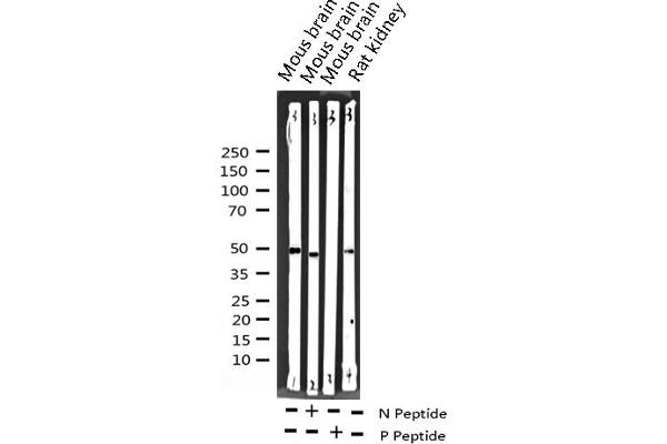 SRF 抗体  (pSer99)