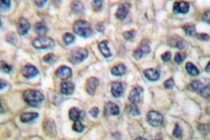 Image no. 1 for anti-Junction Plakoglobin (JUP) antibody (ABIN265337) (JUP antibody)