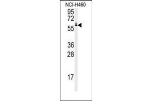 Image no. 1 for anti-Runt-Related Transcription Factor 2 (RUNX2) (Ser6533) antibody (ABIN360019) (RUNX2 antibody  (Ser6533))