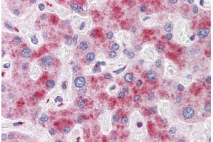 Immunohistochemistry (Formalin-fixed Paraffin-embedded Sections) (IHC (fp)) image for anti-ATG16 Autophagy Related 16-Like 1 (ATG16L1) (AA 38-87) antibody (ABIN6747150)