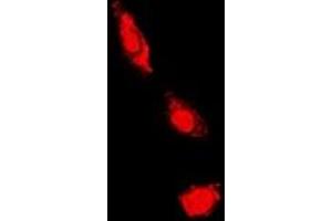 Immunofluorescent analysis of PKC iota/zeta staining in HeLa cells. (PKC iota/zeta antibody)