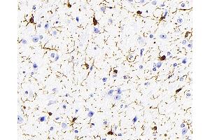 Immunohistochemistry analysis of paraffin-embedded mouse brain using AIF1 Monoclonal Antibody at dilution of 1:400. (Iba1 antibody)