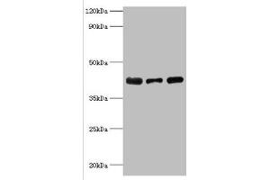 Western blot All lanes: Alpha-2, 8-sialyltransferase 8B antibody at 8 μg/mL Lane 1: Mouse heart tissue Lane 2: HepG2 whole cell lysate Lane 3: Mouse kidney tissue Secondary Goat polyclonal to rabbit IgG at 1/10000 dilution Predicted band size: 42 kDa Observed band size: 42 kDa (ST8SIA2 antibody  (AA 24-160))