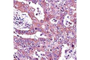Immunohistochemistry (IHC) image for anti-Janus Kinase 2 (JAK2) (AA 666-694) antibody (ABIN3031509)