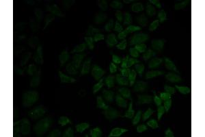 Immunofluorescence analysis of HeLa cell using MSN antibody. (Moesin antibody)