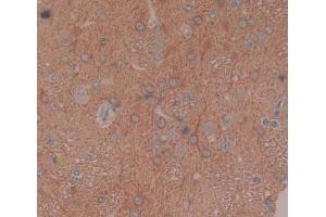 Used in DAB staining on fromalin fixed paraffin- embedded brain tissue (BCAT1 antibody  (AA 179-411))