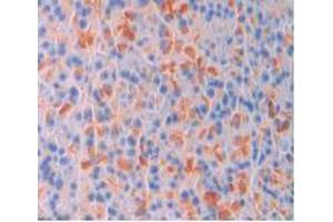 Figure. (CD47 antibody  (AA 18-219))