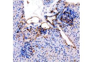 IHC analysis of CD31/Pecam1 using anti-CD31/Pecam1 antibody (ABIN7601662).