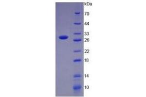 SDS-PAGE of Protein Standard from the Kit (Highly purified E. (PD-L1 ELISA Kit)