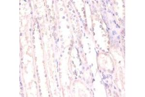 Immunohistochemistry of paraffin-embedded human kidney tissue using ABIN7168366 at dilution of 1:100 (FUS antibody  (AA 1-198))