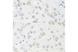 Immunohistochemistry of paraffin-embedded rat brain using PI antibody (ABIN6128452, ABIN6145599, ABIN6145601 and ABIN6222851) at dilution of 1:100 (40x lens). (PIAS3 antibody  (AA 452-628))