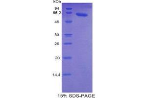 SDS-PAGE (SDS) image for Fast Skeletal Troponin C (TNNC2) (AA 2-160) protein (His tag,MBP tag) (ABIN1878361) (TNNC2 Protein (AA 2-160) (His tag,MBP tag))
