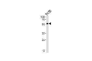 Western Blotting (WB) image for anti-Cytochrome P450, Family 27, Subfamily B, Polypeptide 1 (CYP27B1) antibody (ABIN2897847)