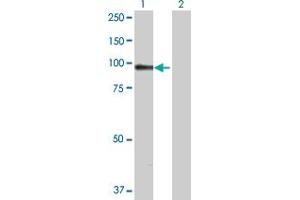 Western Blot analysis of ACTN1 expression in transfected 293T cell line by ACTN1 MaxPab polyclonal antibody.
