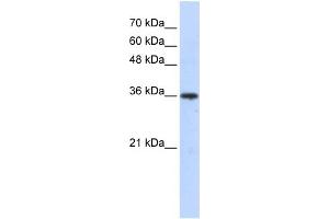 WB Suggested Anti-AKR7A3 Antibody Titration: 0. (AKR7A3 antibody  (Middle Region))