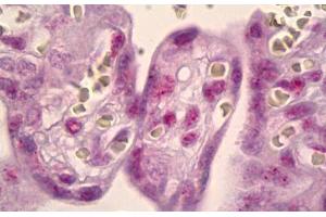 Anti-MSK1 antibody IHC staining of human placenta.