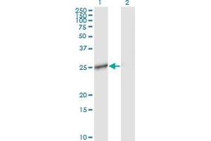 Western Blot analysis of IL27 expression in transfected 293T cell line by IL27 monoclonal antibody (M01), clone 3F12. (IL-27 antibody  (AA 177-243))