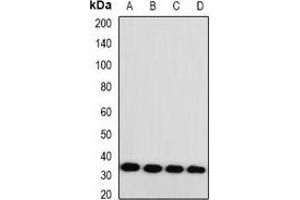 Western blot analysis of Monoglyceride Lipase expression in HT29 (A), SKOV3 (B), mouse heart (C), mouse brain (D) whole cell lysates. (MGLL antibody)