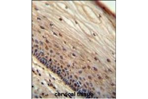 WIBG antibody (N-term) (ABIN654666 and ABIN2844362) immunohistochemistry analysis in formalin fixed and paraffin embedded human cervical tissue followed by peroxidase conjugation of the secondary antibody and DAB staining. (PYM antibody  (N-Term))