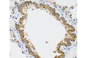 Immunohistochemistry of paraffin-embedded Rat lung using CHMP4B Polyclonal Antibody at dilution of 1:100 (40x lens). (CHMP4B antibody)