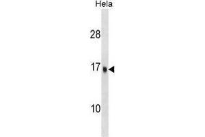 UBE2D3 Antibody (C-term) western blot analysis in Hela cell line lysates (35 µg/lane). (UBE2D3 antibody  (C-Term))