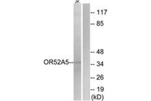 Western blot analysis of extracts from Jurkat cells, using OR52A5 Antibody. (OR52A5 antibody  (AA 160-209))