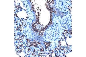 Immunohistochemistry of paraffin-embedded rat lung using MUC1 Rabbit pAb (ABIN6131522, ABIN6144194, ABIN6144195 and ABIN6213810) at dilution of 1:100 (40x lens). (MUC1 antibody  (AA 1182-1255))
