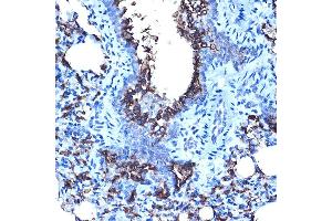 Immunohistochemistry of paraffin-embedded rat lung using MUC1 Rabbit pAb (ABIN6131522, ABIN6144194, ABIN6144195 and ABIN6213810) at dilution of 1:100 (40x lens).