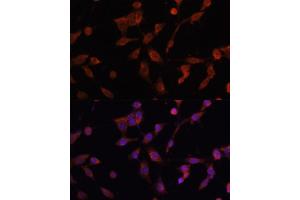 Immunofluorescence analysis of NIH/3T3 cells using L antibody (ABIN6130048, ABIN6143079, ABIN6143080 and ABIN6215226) at dilution of 1:100. (LAMP1 antibody  (AA 80-280))