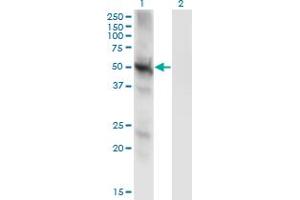 Western Blot analysis of PPP3CC expression in transfected 293T cell line by PPP3CC monoclonal antibody (M01), clone 4D1. (PPP3CC antibody  (AA 1-81))